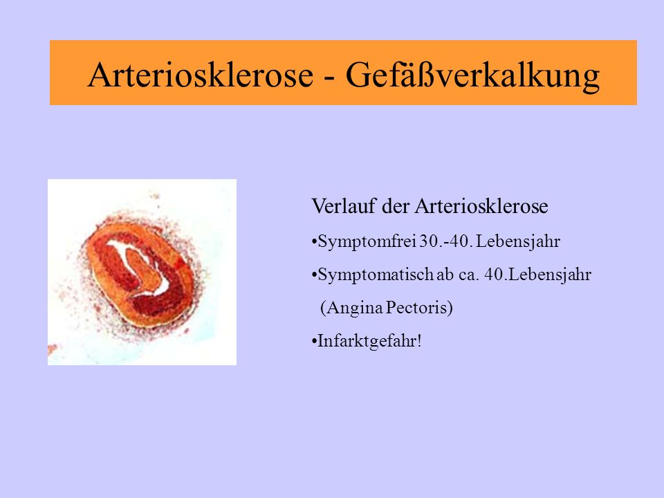 Arteriosklerose - Gefäßverkalkung Verlauf der Arteriosklerose Symptomfrei
