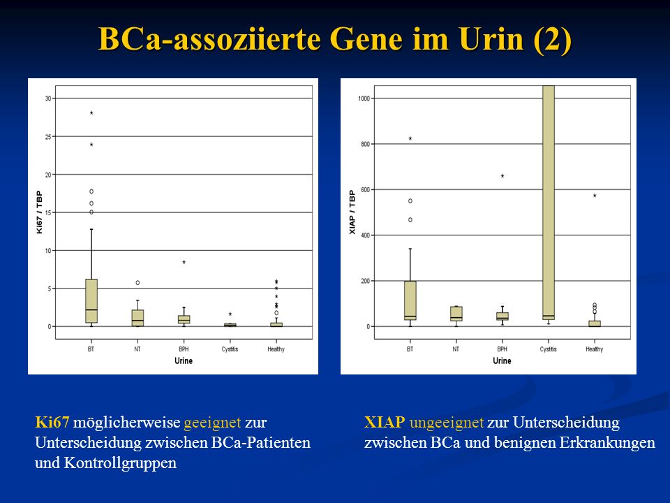 BCa-assoziierte Gene im Urin (2) Ki67 möglicherweise geeignet zur Unterscheidung zwischen BCa-Patienten und Kontrollgruppen XIAP ungeeignet zur Unterscheidung zwischen BCa und benignen Erkrankungen