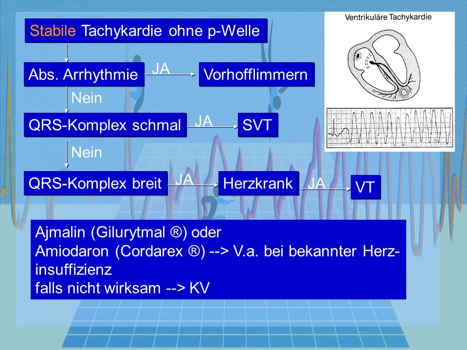 Stabile Tachykardie ohne p-Welle QRS-Komplex schmal QRS-Komplex breit Herzkrank Abs.