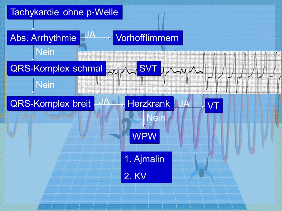 Tachykardie ohne p-Welle QRS-Komplex schmal QRS-Komplex breit Herzkrank Abs.