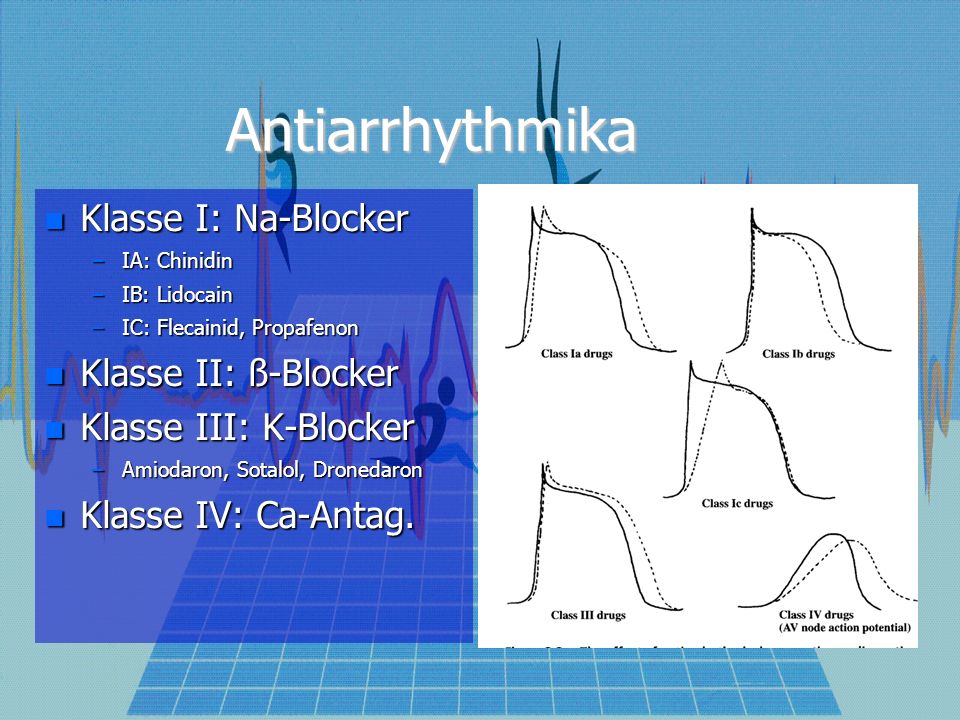 Antiarrhythmika Klasse I: Na-Blocker Klasse I: Na-Blocker –IA: Chinidin –IB: Lidocain –IC: Flecainid, Propafenon Klasse II: ß-Blocker Klasse II: ß-Blocker Klasse III: K-Blocker Klasse III: K-Blocker –Amiodaron, Sotalol, Dronedaron Klasse IV: Ca-Antag.
