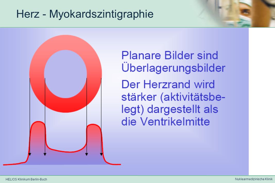 HELIOS Klinikum Berlin-Buch Nuklearmedizinische Klinik Herz – Myokardszintigraphie
