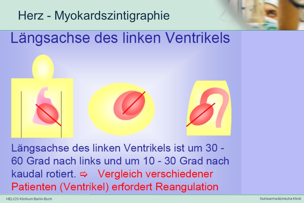 HELIOS Klinikum Berlin-Buch Nuklearmedizinische Klinik Herz - Myokardszintigraphie