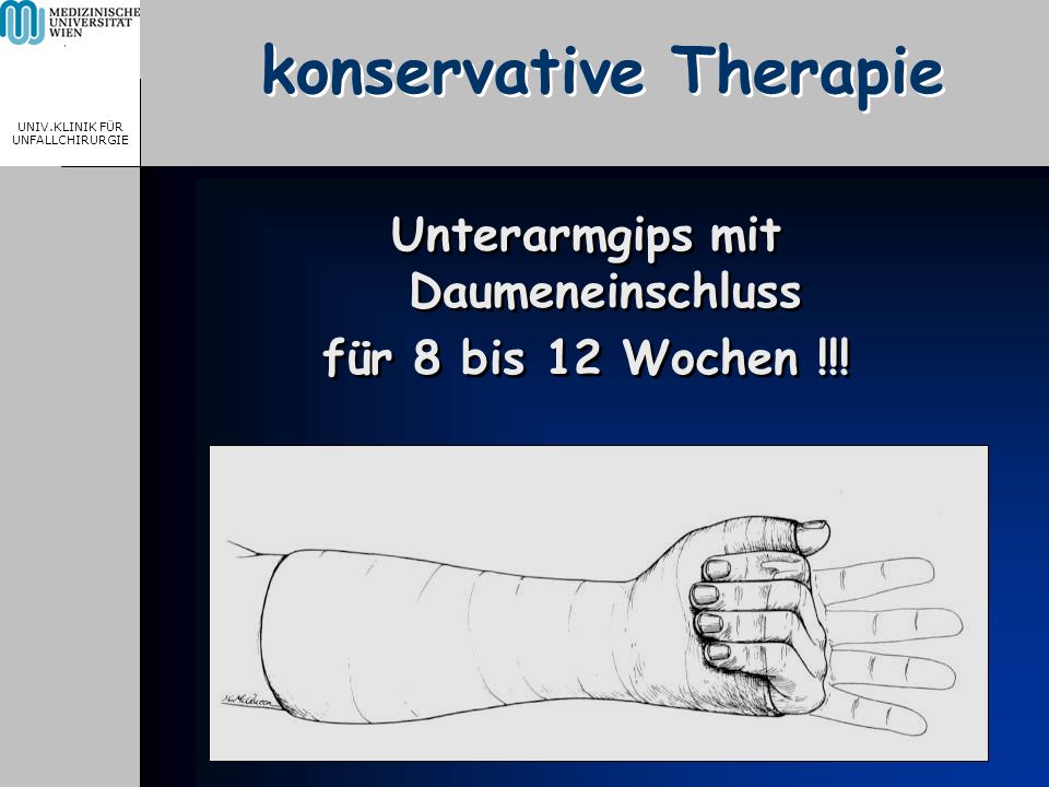 MEDICAL UNIVERSITY, VIENNA, AUSTRIA UNIV.KLINIK FÜR UNFALLCHIRURGIE konservative Therapie Unterarmgips mit Daumeneinschluss für 8 bis 12 Wochen !!.