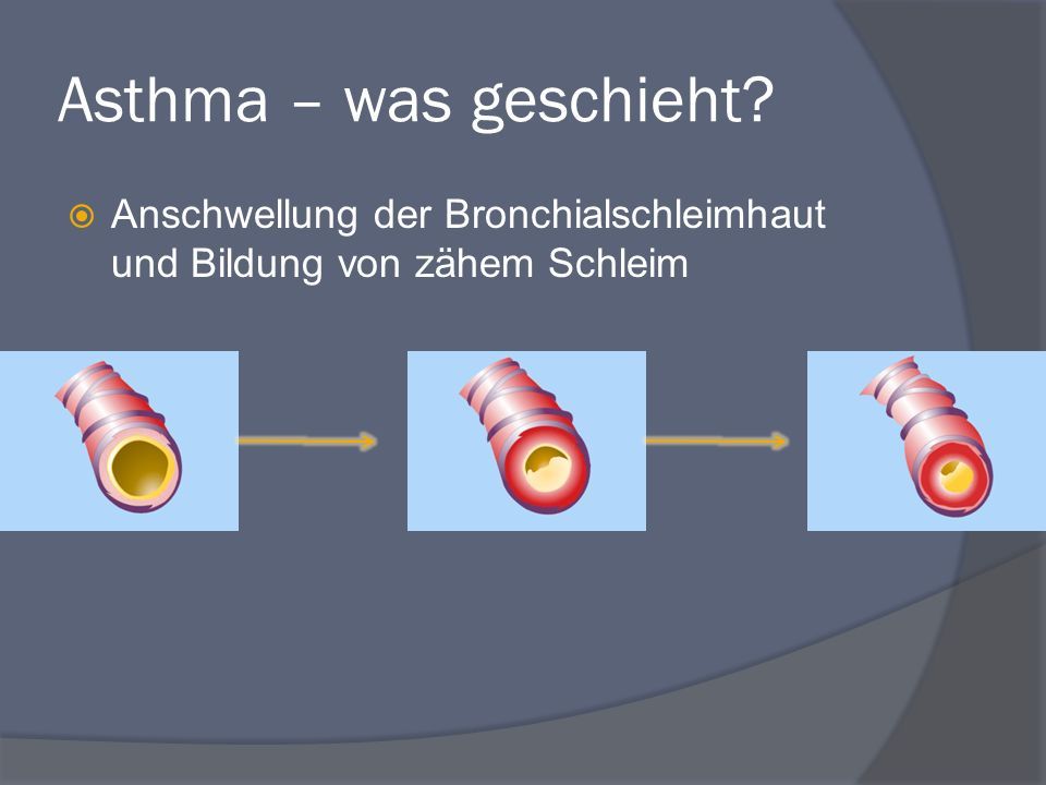 Asthma – was geschieht  Anschwellung der Bronchialschleimhaut und Bildung von zähem Schleim